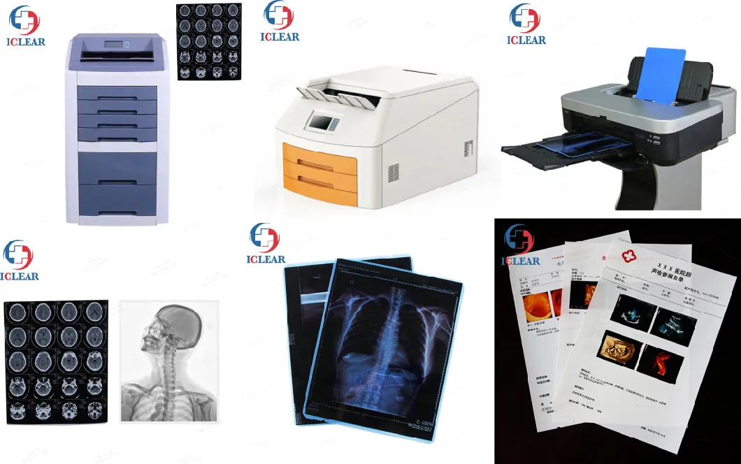 High Quality 8 X 10 in/10 X 12 in/11 X 14 in/14 X 17 in Medical X Ray Dry Film